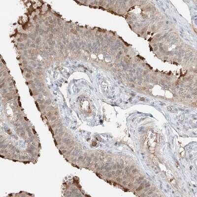 Immunohistochemistry-Paraffin: QN1 Antibody [NBP1-91158]