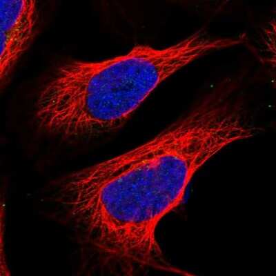 Immunocytochemistry/ Immunofluorescence: QPCTL Antibody [NBP1-82208]