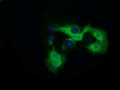 Immunocytochemistry/ Immunofluorescence: QPRT Antibody (OTI1C10) [NBP2-02860]
