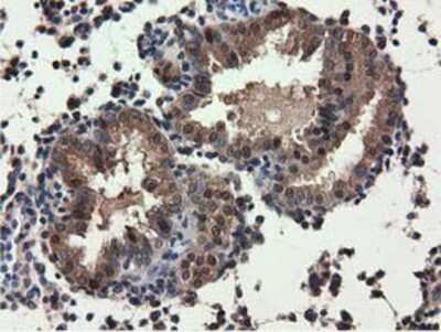 Immunohistochemistry-Paraffin: QPRT Antibody (OTI1C10) [NBP2-02860]