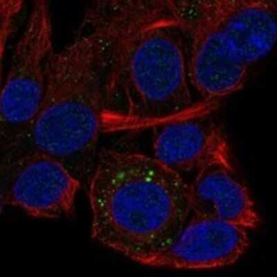 Immunocytochemistry/ Immunofluorescence: QPRT Antibody [NBP3-17089]