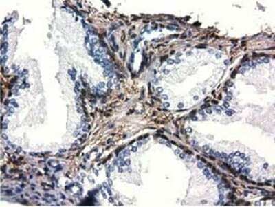 Immunohistochemistry: QPRT Antibody (OTI1C10) - Azide and BSA Free [NBP2-73761]