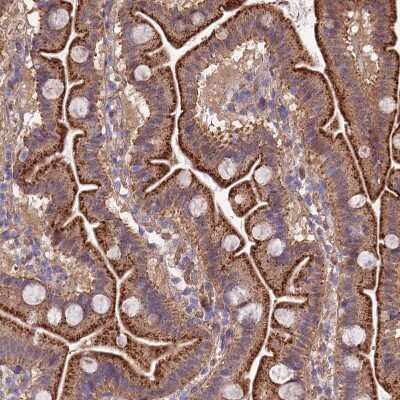 Immunohistochemistry-Paraffin: QRFP Antibody [NBP1-94144]