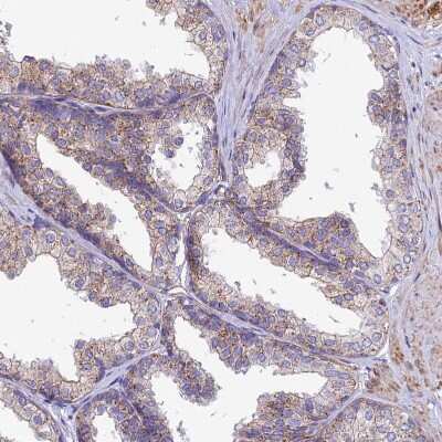 Immunohistochemistry-Paraffin: QRFP Antibody [NBP1-94144]