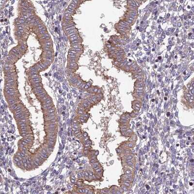 Immunohistochemistry-Paraffin: QRFP Antibody [NBP1-94144]