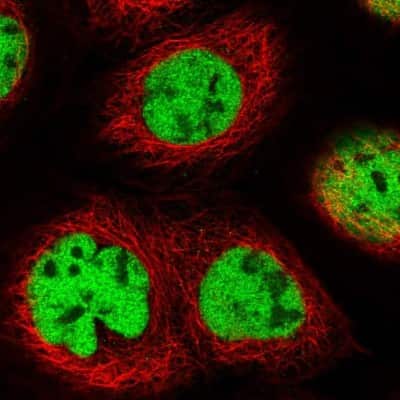 Immunocytochemistry/ Immunofluorescence: QRICH1 Antibody [NBP1-82196]