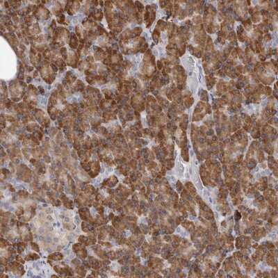 Immunohistochemistry-Paraffin: QRSL Antibody [NBP1-87992]