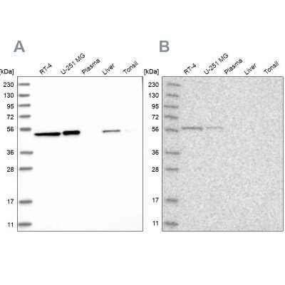 Western Blot: QRSL Antibody [NBP1-87992]