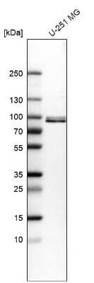 Western Blot: QSOX1/Quiescin Q6 Antibody [NBP2-55409]