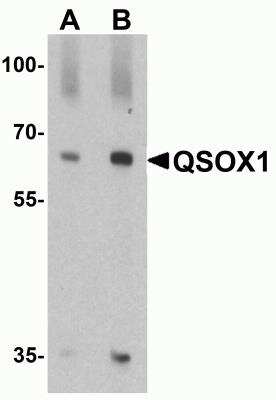 Western Blot: QSOX1/Quiescin Q6 AntibodyBSA Free [NBP2-81797]