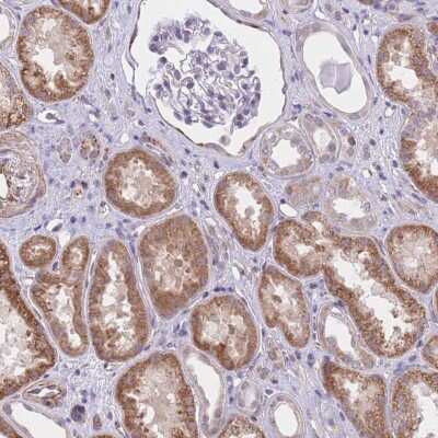 Immunohistochemistry: QTRT1 Antibody [NBP2-47317]