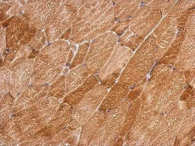 Immunohistochemistry-Paraffin: QTRT1 Antibody [NBP2-20030]