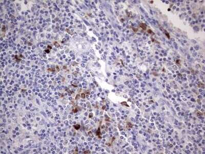 Immunohistochemistry: R-Spondin 1 Antibody (OTI11A9) - Azide and BSA Free [NBP2-73948]