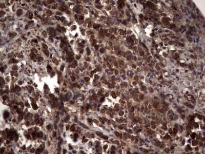 Immunohistochemistry: R-Spondin 3 Antibody (OTI3D5) [NBP2-45637]
