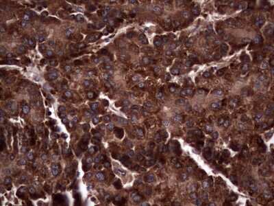 Immunohistochemistry: R-Spondin 3 Antibody (OTI3D5) [NBP2-45637]