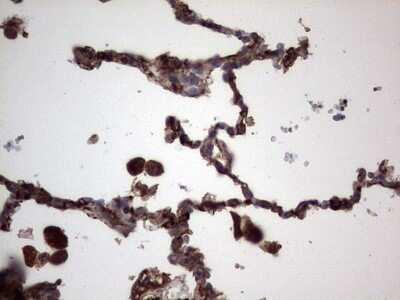 Immunohistochemistry: R-Spondin 3 Antibody (OTI3D5) [NBP2-45637]