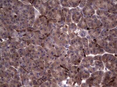 Immunohistochemistry: R-Spondin 3 Antibody (OTI3D5) [NBP2-45637]