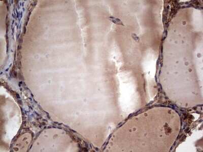 Immunohistochemistry: R-Spondin 3 Antibody (OTI3D5) [NBP2-45637]