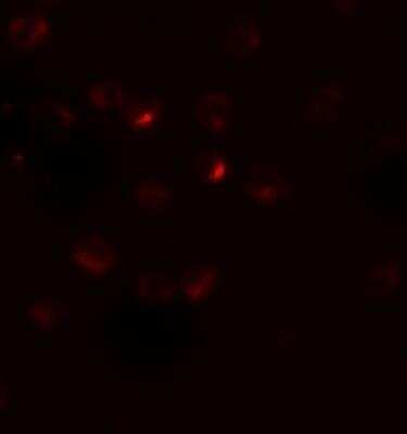 Immunocytochemistry/ Immunofluorescence: R-Spondin 3 Antibody - BSA Free [NBP2-81849]