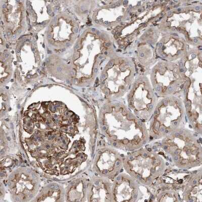 Immunohistochemistry-Paraffin: R-Spondin 3 Antibody [NBP1-82234]