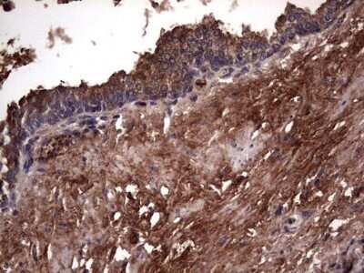Immunohistochemistry: R-Spondin 3 Antibody (OTI3D5) - Azide and BSA Free [NBP2-73949]