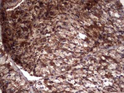 Immunohistochemistry: R-Spondin 3 Antibody (OTI3D5) - Azide and BSA Free [NBP2-73949]