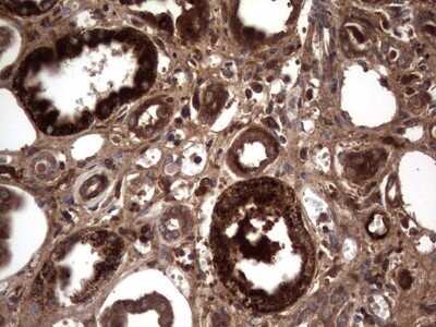 Immunohistochemistry: R-Spondin 3 Antibody (OTI3D5) - Azide and BSA Free [NBP2-73949]