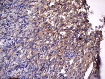 Immunohistochemistry: R-Spondin 3 Antibody (OTI3D5) - Azide and BSA Free [NBP2-73949]