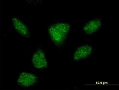 Immunocytochemistry/ Immunofluorescence: R3HDM2 Antibody [H00022864-B01P]