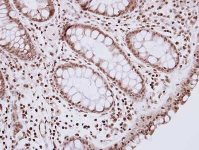 Immunohistochemistry-Paraffin: R3HDM2 Antibody [NBP2-20032]