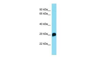 Western Blot: R3HDM4 Antibody [NBP2-85567]