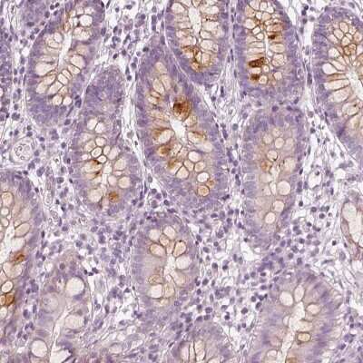 Immunohistochemistry-Paraffin: R3HDML Antibody [NBP2-56029]