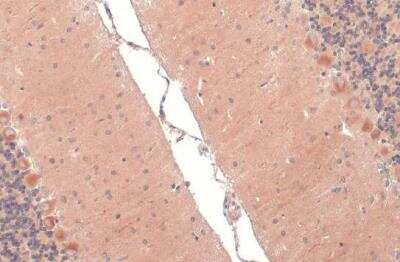 Immunohistochemistry-Paraffin: RAB11B Antibody [NBP2-15085]