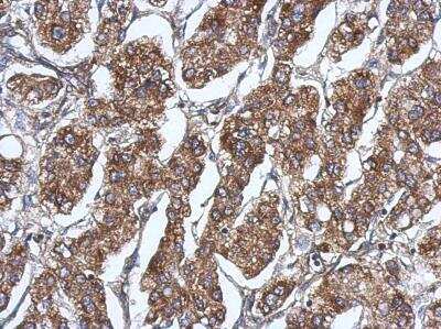 Immunohistochemistry-Paraffin: RAB11FIP5 Antibody [NBP2-20035]