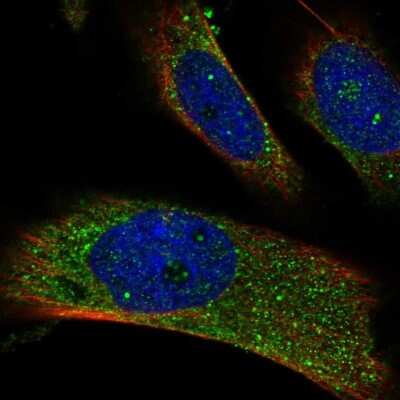 Immunocytochemistry/ Immunofluorescence: RAB14 Antibody [NBP1-84720]