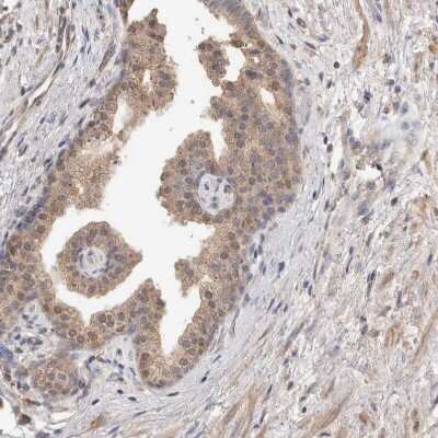 Immunohistochemistry-Paraffin: RAB14 Antibody [NBP1-84720]