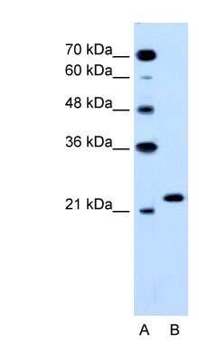 Western Blot: RAB14 Antibody [NBP1-79962]