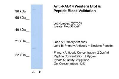 Western Blot: RAB14 Antibody [NBP1-79962]