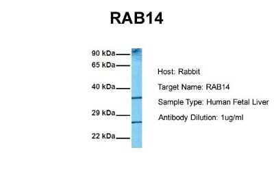 Western Blot: RAB14 Antibody [NBP1-79962]