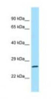 Western Blot: RAB1B Antibody [NBP1-98500]