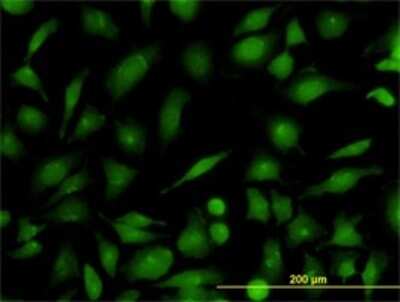 Immunocytochemistry/ Immunofluorescence: RAB21 Antibody (1F6) [H00023011-M01]