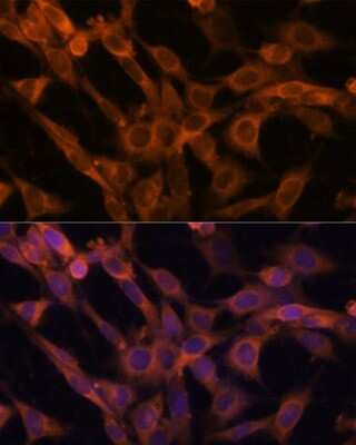 Immunocytochemistry/ Immunofluorescence: RAB21 Antibody - Azide and BSA Free [NBP2-93771]
