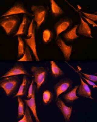 Immunocytochemistry/ Immunofluorescence: RAB21 Antibody - Azide and BSA Free [NBP2-93771]