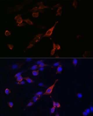 Immunocytochemistry/ Immunofluorescence: RAB21 Antibody - Azide and BSA Free [NBP2-93771]