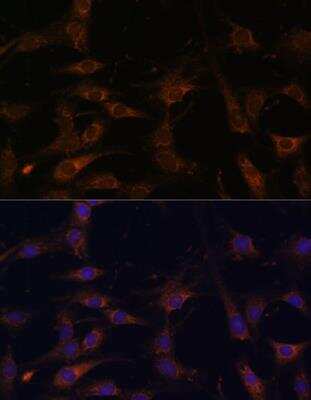 Immunocytochemistry/ Immunofluorescence: RAB21 Antibody - Azide and BSA Free [NBP2-93771]