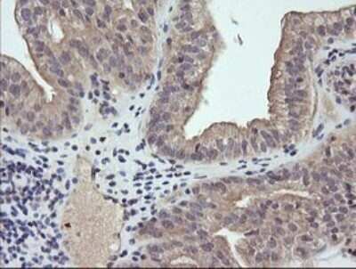 Immunohistochemistry: RAB21 Antibody (OTI6E12) - Azide and BSA Free [NBP2-73769]
