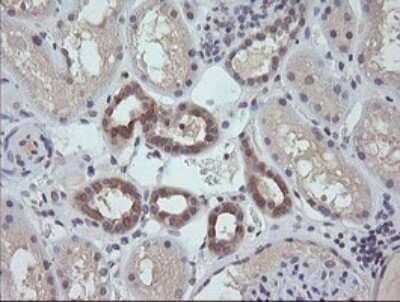 Immunohistochemistry: RAB21 Antibody (OTI6E12) - Azide and BSA Free [NBP2-73769]