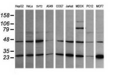 Western Blot: RAB21 Antibody (OTI6E12) [NBP2-45497]