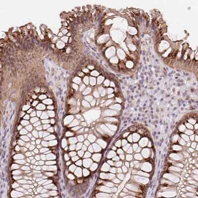 Immunohistochemistry: RAB22A Antibody [NBP2-39080]