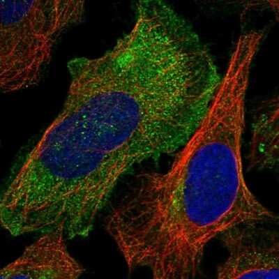 Immunocytochemistry/ Immunofluorescence: RAB23 Antibody [NBP1-86366]